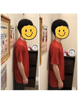 蕨整体院/腰痛/骨盤矯正/蕨/整体