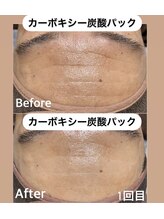 ケーナインエッセ(K9 esse)/カーボキシー炭酸パック