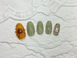 定額トレンド
