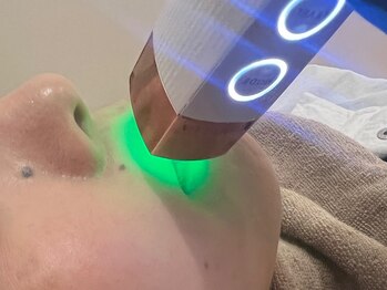 ジジベレッザ 芦屋店(jiji belleza)/LEMELLA(ルメラ) /リップケア