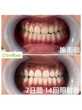 ルブラン 奈良店(Le Blanc)/成人式の前撮りに向けて！