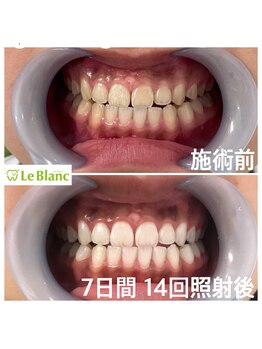 ルブラン 奈良店(Le Blanc)/成人式の前撮りに向けて!