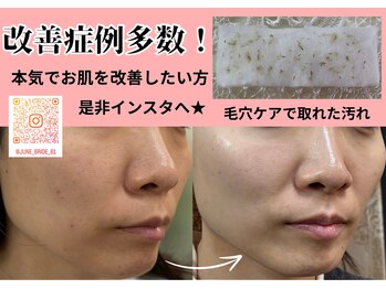 ジューンブライド(June Bride 61)/毛穴ケア