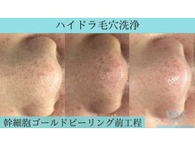 リメイク 広尾(REMAKE)/