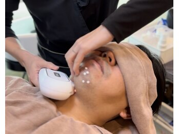 アッシュボウプラス(H.beau+)/全顔施術中