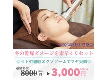 エステサロンプリマージュ(Primage)の雰囲気（人気大好評◎今だけ超お得◎【シンプルケア】でご予約ください。）