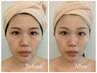 【はじめての方(チラシ持参の方)はこちら】リフトアップコース