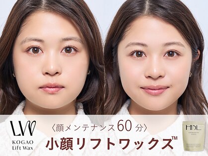 ノーブルの写真