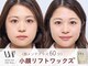ノーブルの写真