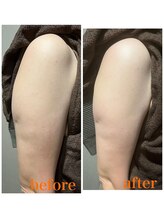 ラナチュール/二の腕の厚みに！