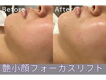 クレドペール(Eclat de Perles)