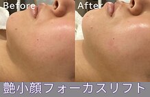 クレドペール(Eclat de Perles)