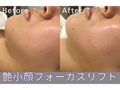 クレドペール(Eclat de Perles)の写真