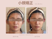 カイロプラクテックサロンドアール(Salon de R)