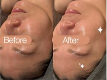 クレヴィア バイ サイバーエステ(CREBIA)/◎40代以上の方におすすめ◎