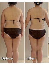 ヒールプラス(heal+)/1ヶ月通っていただきました