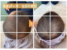 ラフィング(Laughing)/赤ちゃん整体