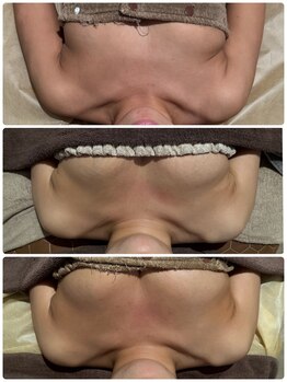 レイア 中城店(RayA)/本気の育乳コース☆3-6ヶ月