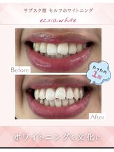 エクシアホワイト 立川南口店/立川で人気のセルホワイトニング