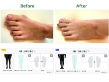 サロンラグナ(Salon Laguna)/お客様例：足部調整｜フットケア