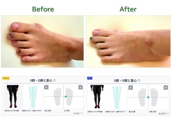 サロンラグナ(Salon Laguna)/お客様例：足部調整｜フットケア