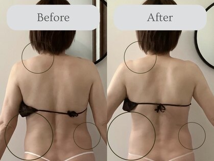 エミィ(emmy)の写真