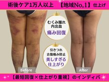 インディバ痩身サロン プルミエ(premier)