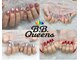 ビービークイーンズ(B.B. Queens)の写真