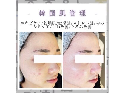 ポムハヌル(pom.haneul)の写真
