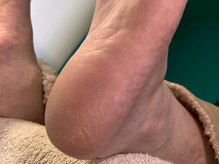 リアンジェ(Lianje)/かかとケア