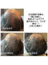 ココリ(CoCoRe)/育毛促進メニュー始まりました！