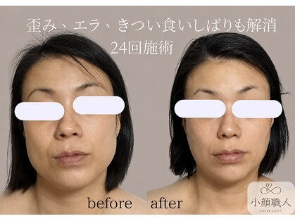 小顔職人の写真