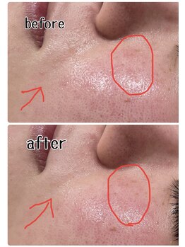 ラティメリア(Latimeria)/水素水フェイシャルで綺麗！