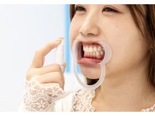 ホワイトニングカフェ 綾瀬店(WhiteningCafe)/☆施術は全てサポート付き