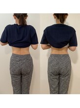 オブライフ(OF LIFE)/ビフォーアフターその５