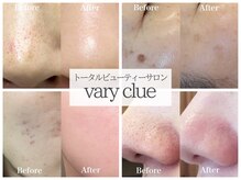 ヴァリークルー(vary clue)