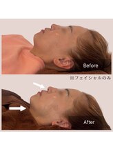 フェムーン(FEMOON)/即効性♪小顔リンパフェイシャル