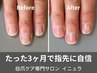 二枚爪・割れやすい爪を徹底改善！ネイルケアプログラムの初回体験