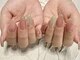 オウパル(OPAL)の写真/【美爪☆自爪ケア特化型ネイルサロン】指先から美しく♪二枚爪、深爪、巻き爪などでお悩みの方にも◎