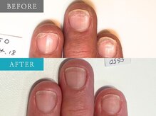 育爪 梅田店/育爪カルテ