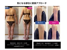 メルシー(Merci)の雰囲気（気になる部位に直接働きかけることで、身体のラインを整えます。）