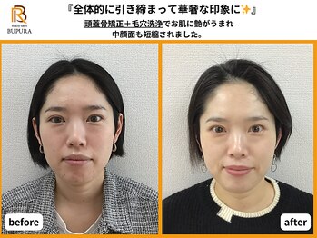 ブプラ 香椎店(BUPURA)/before→after