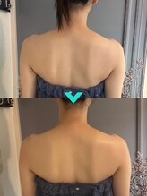 ミルキー(Milky)/身体の歪みを整える