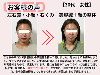 サロンスマイル/お客様の声before/after