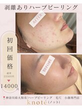 ノット(knote)/衝撃ビフォアフ4