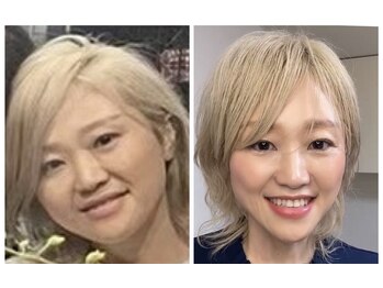 メテ(mete)の写真/知らないと損。そのたるみは自分の手で変えられる。美容医療の前に試してほしい4ヶ月オンライン講座相談