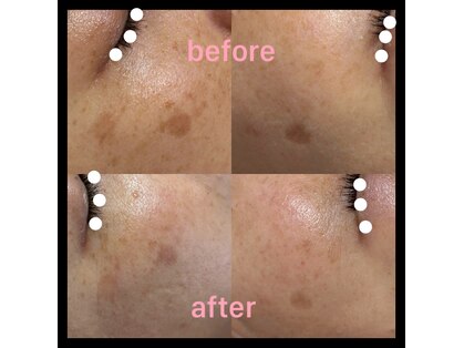 ココスタイルビューティー(COCOSTYLE beauty)の写真