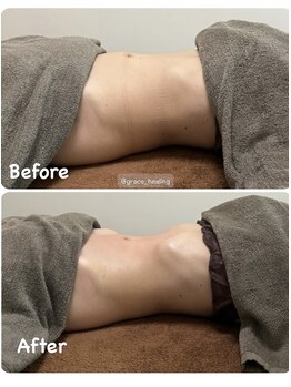 グレースヒーリング(GRACE HEALING)/本日の腸もみ
