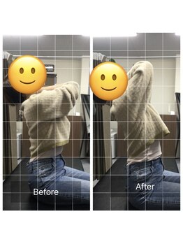 ナオル整体 センター南院(NAORU整体)/背骨の反り具合のBefore After