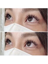 グリッターネイル(GLITTER NAILS)/アンドヘルシー